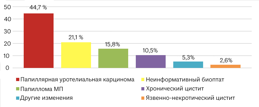 Результаты гистологического исследования рака мочевого пузыря