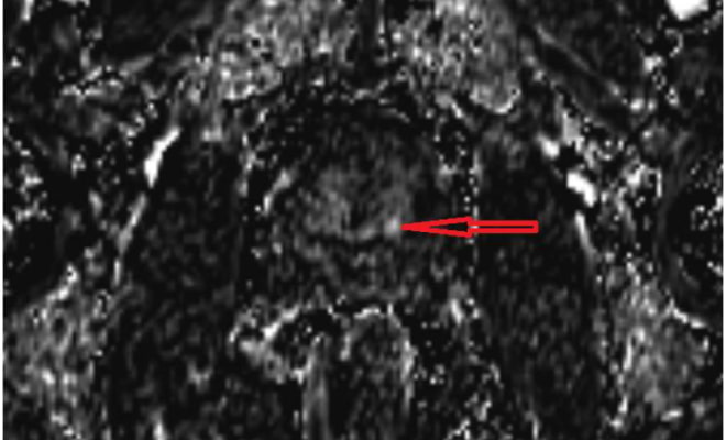 mrt-s-kontrastirovaniem