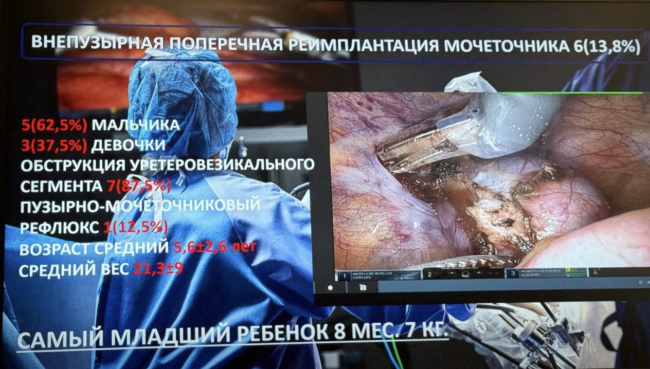 Робот-ассистированная хирургия в педиатрии
