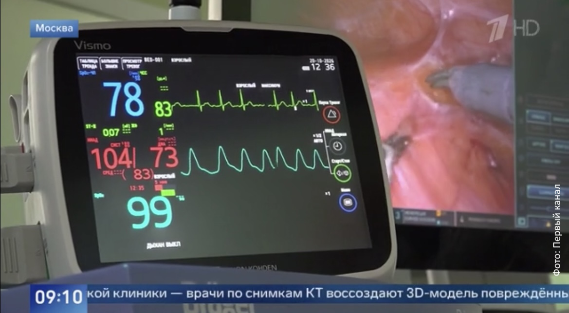 В Сеченовском Университете выполнили 5 000 операций с da Vinci