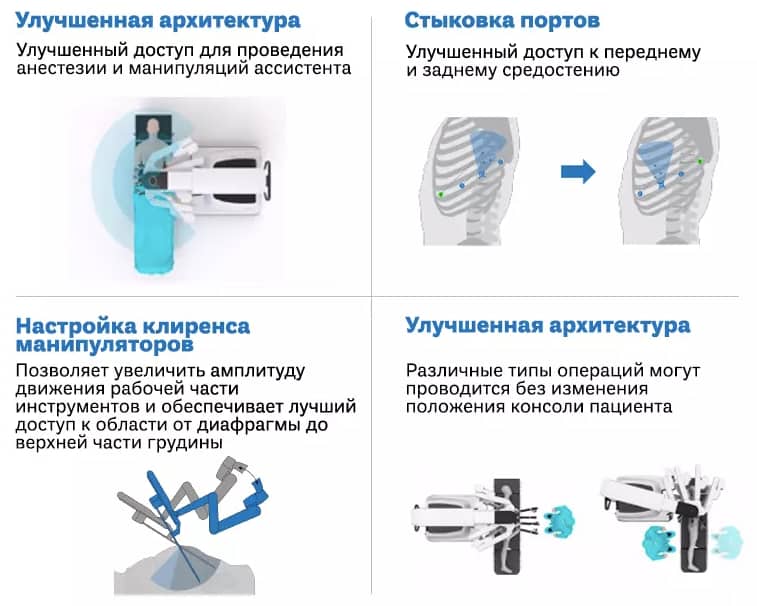 Преимущества использования da Vinci Xi в торакальной хирургии