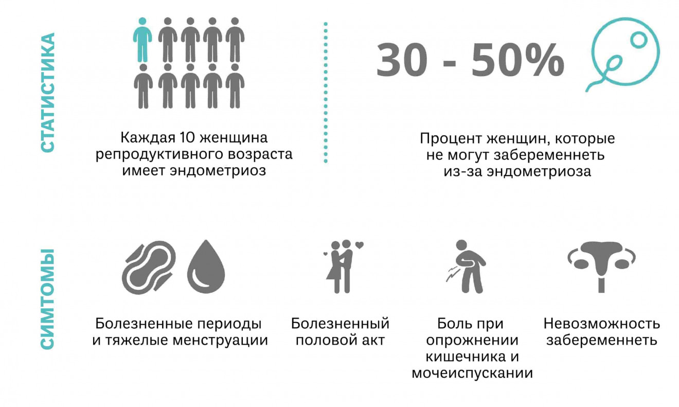 Влияние эндометриоза на репродуктивное здоровье женщины