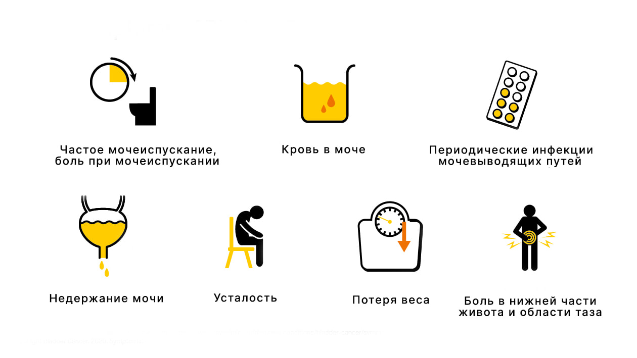 Симптомы рака мочевого пузыря