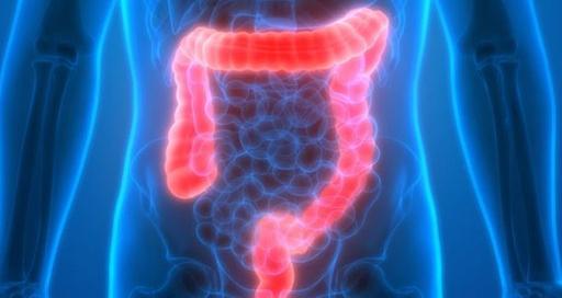 Colon channel